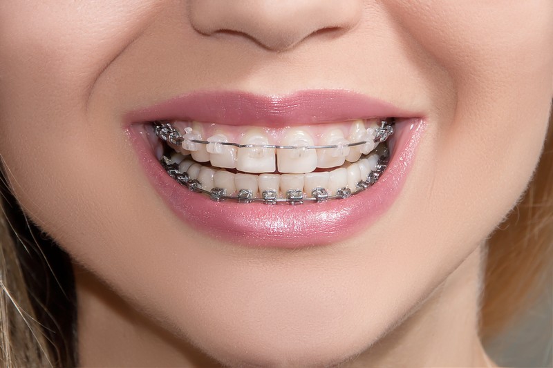 Orthodontic Services