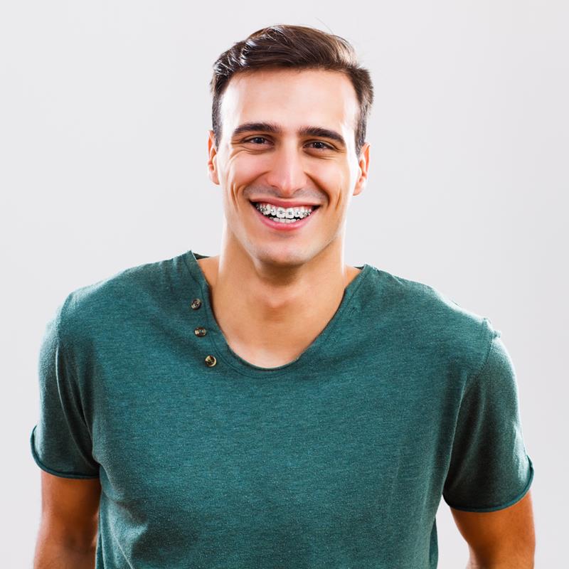 Adult Orthodontic Treatment